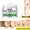 Body Whitening Cream Underarm Knee Buttocks Private Bleach Remove Melanin Pigmentation Improve Dull Nourish Brighten Skin Care - TheWellBeing4All