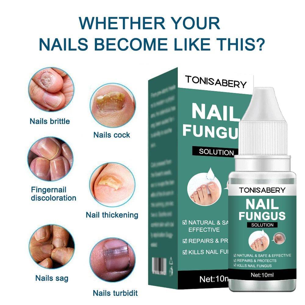 Nail Fungal Treatment Feet Care Essence  Anti Infection Paronychia Onychomycosis Nail Foot Toe Nail Fungus Removal Gel Products - TheWellBeing4All