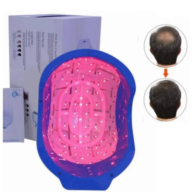 Hair Regrowth Laser Helmet Anti Hair Loss Treament Hair Growth Cap Hair Loss Therapy Device Hair Laser Therapy Massage Machine - TheWellBeing4All