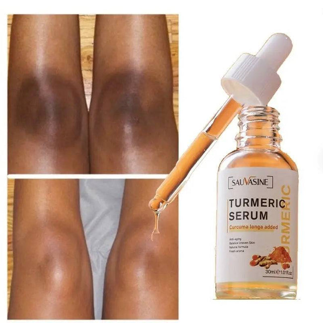 Turmeric Lemon Oil Skin Glow To Lightening Acne Dark Patches, Acne Bright Skin Dark Spot Corrector Face Whitening Serum - TheWellBeing4All