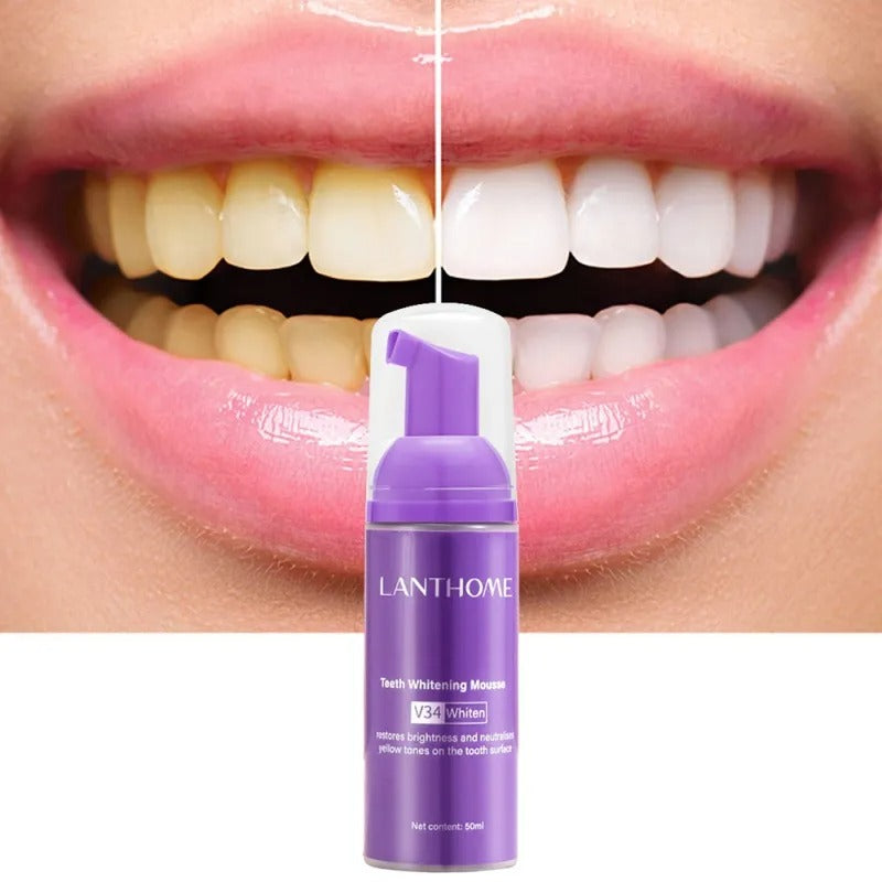 Toothpaste Mousse V34 - Your Solution to Teeth Cleaning, Whitening, and Stain Removal - TheWellBeing4All